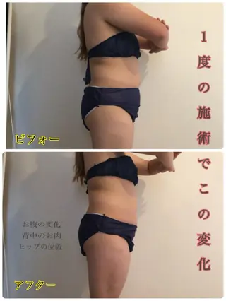 ❤︎MN❤︎ モンのエステ・リラクイメージ