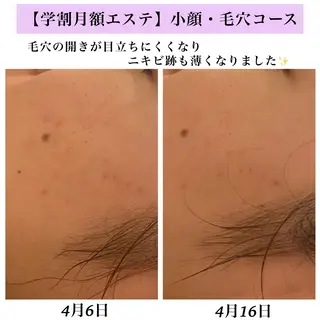 Bellesthe （ベルエステ）のエステ・リラクイメージ