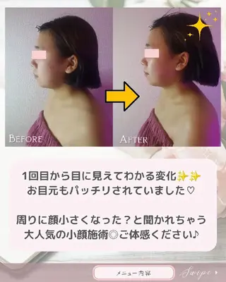 痩身ハーブピーリング 筋膜リリース☆B&Hのエステ・リラクイメージ