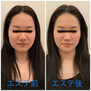 ポーラザビューティー 松原店のエステ・リラクイメージ