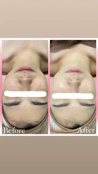 salon〜RePCa〜(サロンルピカ)所属・山﨑 藍のエステ・リラクイメージ