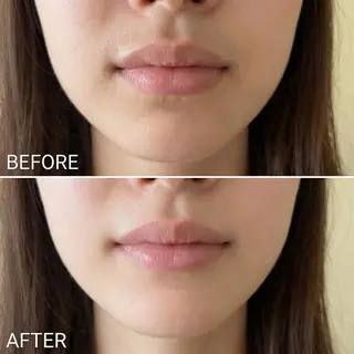 脱毛×肌管理サロン ルネルのエステ・リラクイメージ