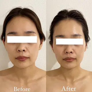 MOREB'S所属・MOREB'S サラのエステ・リラクイメージ