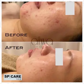 ビューティサロン aiwaのエステ・リラクイメージ