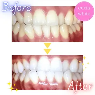 ecxia  white 　広島袋町店所属・セルフホワイトニング エクシア広島袋町店のその他イメージ