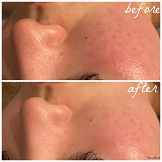 メンズ メナード岐阜市茜部 杉浦のエステ・リラクイメージ