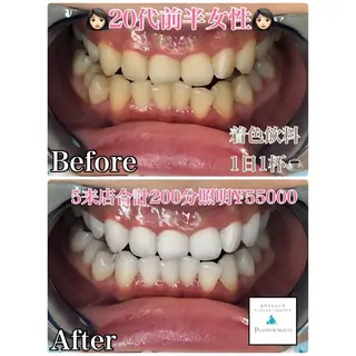 ホワイトニングビューティー西宮店所属・ホワイトニングビュー ティー西宮店のその他イメージ