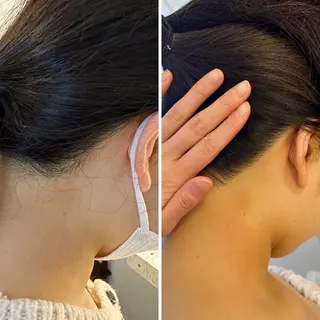 うなじ脱毛/美肌脱毛 LABELのエステ・リラクイメージ