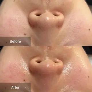 本気の小顔×毛穴ケア ／もりやま はるかのエステ・リラクイメージ