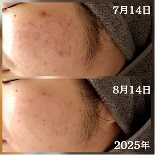 フェイシャル専門サロ ン ERINのエステ・リラクイメージ