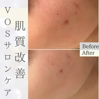 Purua beuty所属・月1肌管理 RINAのエステ・リラクイメージ