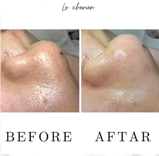 Le  cherien ル シェリア所属・毛穴洗浄/ハイフ サロンのエステ・リラクイメージ