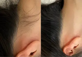 MINOA所属・MINOA 井上🌷のエステ・リラクイメージ