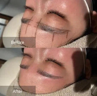 アイブロウ for woman所属・森 美優のエステ・リラクイメージ