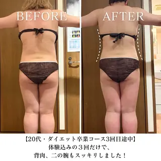 【三軒茶屋/下馬】 本格痩身・よもぎ蒸しのエステ・リラクイメージ