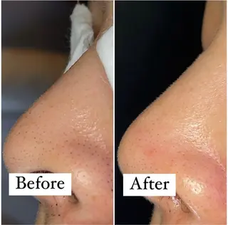 エステサロン Y.GRACEのエステ・リラクイメージ