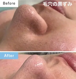 オーガニック エステ サロンフィオーレの眉毛・アイブロウイメージ