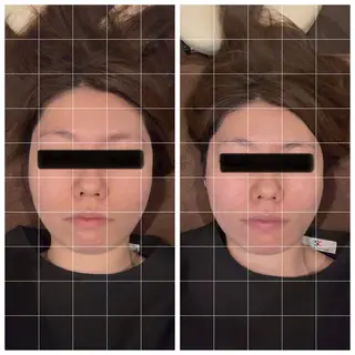 Ka'mua所属・Ka'mua HARUKAのエステ・リラクイメージ