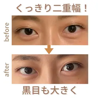 小顔サロン AMYONのエステ・リラクイメージ