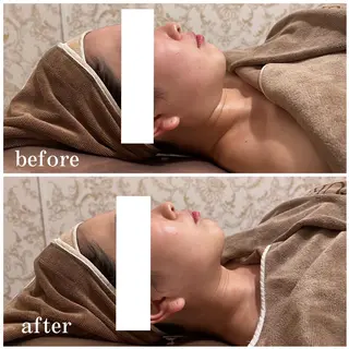 西区九条エステ MITUREIサロンのエステ・リラクイメージ