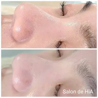 Salon de  HiAのエステ・リラクイメージ