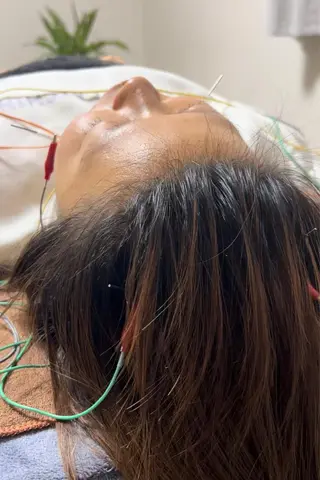 鍼灸サロンはりみ所属・片山 よしみのその他イメージ