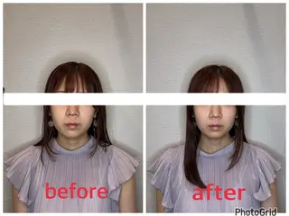 小林整骨院本町 美容鍼roomのエステ・リラクイメージ