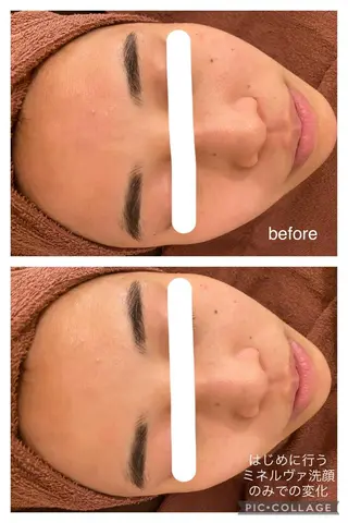 夏までに肌荒れ卒業 するサロン🌻のエステ・リラクイメージ