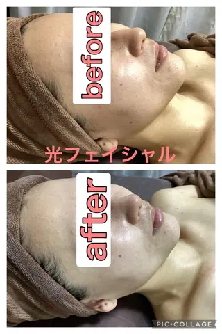 salon   du ひゃーく/横山のエステ・リラクイメージ