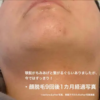 メンズ TEDDY BASE 眉＆脱毛サロンのエステ・リラクイメージ