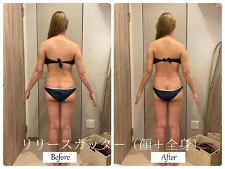 ブライダルサロン ｜Lino【堀江】のエステ・リラクイメージ