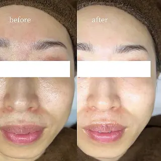 韓国肌管理・肌質改善 EARNEST心斎橋のエステ・リラクイメージ