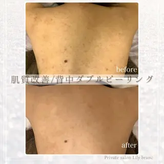 Lily branc 痩身/小顔/肌質改善のエステ・リラクイメージ