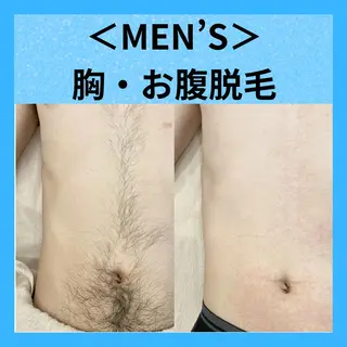 （男）脱毛サロン KING&QUEENのエステ・リラクイメージ