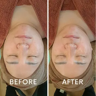 鍼灸サロンmiyabi所属・美容鍼×エステ　鍼灸 サロンmiyabiのエステ・リラクイメージ