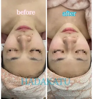 総合エステサロン 肌活のエステ・リラクイメージ