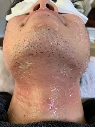 脱毛サロン CHAPPYのエステ・リラクイメージ