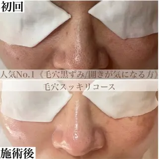 BEAUTY SALON BeLL所属・毛穴ケア専門店 BeLL ベルのエステ・リラクイメージ