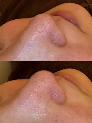 EARTH coiffure beaute 新潟紫竹山店所属・🤍アベシュリ /フェイシャル🤍のエステ・リラクイメージ