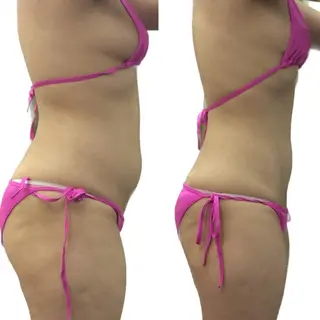 NON-NONプラス 大人の本気痩身のエステ・リラクイメージ