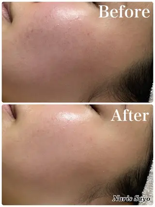 デ・アイム豊中所属・朝山 紗世子のエステ・リラクイメージ