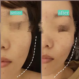 🅖🅤🅩🅔🅛 salonのエステ・リラクイメージ