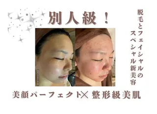 レイビス盛岡店 ♡吉田♡のエステ・リラクイメージ