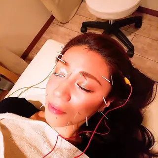 むくみたるみ専門☆ 美容鍼・小顔矯正のエステ・リラクイメージ