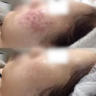 ショート カラー パーマ ヘアアレンジ ネイル マツエク・マツパ アイブロウ 都度払い肌質改善 &脱毛Blancheのエステ・リラクイメージ