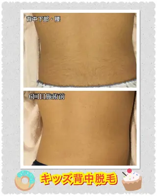 キッズ 【リベルハーブピーリング認定店】敏感肌・美白脱毛専門店Dione立川店所属・Dione 立川店のエステ・リラクイメージ