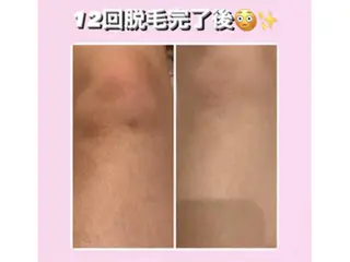 美肌脱毛専門サロン Dione栄店のエステ・リラクイメージ