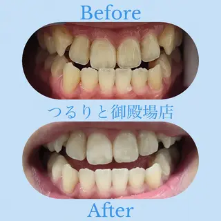 美肌脱毛サロン つるりと御殿場店所属・美肌脱毛サロン つるりとのその他イメージ