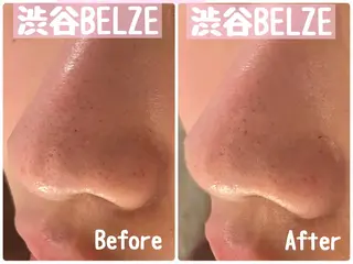 烏水💙BELZE フェイシャル/脱毛のその他イメージ