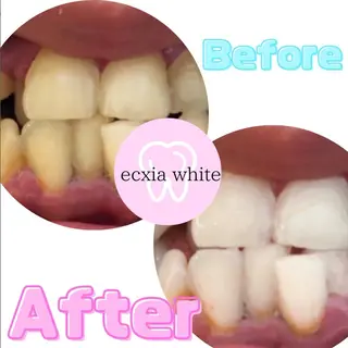 エクシアホワイト千葉駅前店所属・セルフホワイトニング エクシア千葉駅前店のその他イメージ